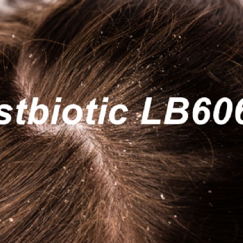 馬拉色菌克星 LB356R? 毛發(fā)救星 頭皮清爽